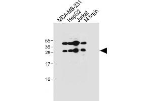 All lanes : Anti-EMX1 Antibody (C-term) at 1:1000 dilution Lane 1: MDA-MB-231 whole cell lysate Lane 2: HepG2 whole cell lysate Lane 3: Jurkat whole cell lysate Lane 4: Mouse brain tissue lysate Lysates/proteins at 20 μg per lane.
