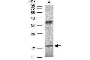 WB Image Sample(30 μg of whole cell lysate) A:H1299 12% SDS PAGE antibody diluted at 1:200 (IFNA6 anticorps  (C-Term))