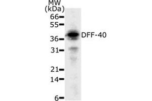 Western Blotting (WB) image for anti-DNA Fragmentation Factor, 40kDa, beta Polypeptide (Caspase-Activated DNase) (DFFB) (AA 205-222) antibody (ABIN208001) (DFFB anticorps  (AA 205-222))