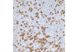 anti-CD45RO (CD45RO) antibody