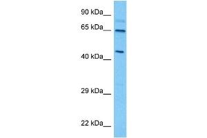 Host:  Mouse  Target Name:  THRA  Sample Tissue:  Mouse Spleen  Antibody Dilution:  1ug/ml