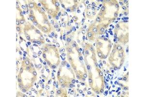 Immunohistochemistry of paraffin-embedded Mouse kidney using PTGES2 Polyclonal Antibody at dilution of 1:100 (40x lens).