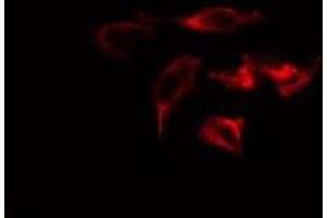 ABIN6275217 staining  Hela cells by IF/ICC. (Macrophage Mannose Receptor 1 anticorps  (Internal Region))