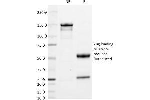 anti-IGHA1 & IGHA2 antibody