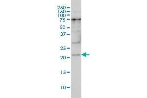 PRKRIP1 monoclonal antibody (M05), clone 4D11-3F11 Western Blot analysis of PRKRIP1 expression in Hela S3 NE . (PRKRIP1 anticorps  (AA 1-184))