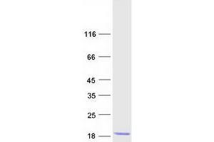 Validation with Western Blot
