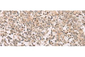 Immunohistochemistry of paraffin-embedded Human tonsil tissue using M1AP Polyclonal Antibody at dilution of 1:80(x200) (Meiosis 1 Associated Protein (M1AP) anticorps)