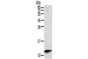 Western Blot analysis of Mouse spleen tissue using PBOV1 Polyclonal Antibody at dilution of 1/200 (PBOV1 anticorps)
