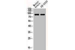 Western Blot analysis of MOUSE-BRAIN SH-SY5Y cells using Phospho-Stat1 (Y701) Polyclonal Antibody
