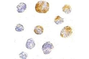 Immunohistochemistry (IHC) image for anti-Kinesin Family Member 5A (KIF5A) (C-Term) antibody (ABIN1030467) (KIF5A anticorps  (C-Term))