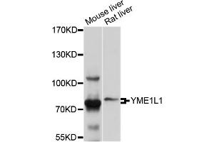 Western blot analysis of extracts of various cell lines, using YME1L1 antibody (ABIN4905647) at 1:1000 dilution. (YME1L1 anticorps)