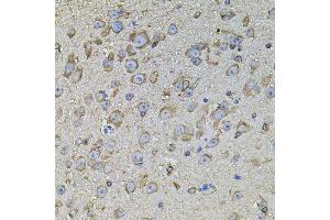 Immunohistochemistry of paraffin-embedded mouse brain using CPOX antibody. (CPOX anticorps  (AA 111-454))