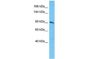 Host:  Rabbit  Target Name:  KCNB1  Sample Type:  721_B Whole Cell lysates  Antibody Dilution:  1.