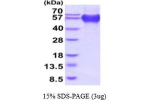 SDS-PAGE (SDS) image for CD68 Molecule (CD68) (AA 22-319) protein (His tag) (ABIN5854759) (CD68 Protein (AA 22-319) (His tag))
