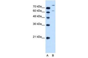 Image no. 2 for anti-Solute Carrier Family 26 (Sulfate Transporter), Member 1 (SLC26A1) (AA 558-607) antibody (ABIN6736662) (SLC26A1 anticorps  (AA 558-607))