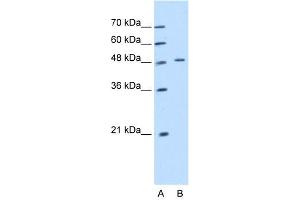 WB Suggested Anti-KRT20  Antibody Titration: 1. (KRT20 anticorps  (Middle Region))