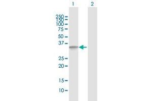 Western Blot analysis of ANKRA2 expression in transfected 293T cell line by ANKRA2 MaxPab polyclonal antibody. (ANKRA2 anticorps  (AA 1-313))