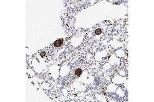Immunohistochemical staining of human bone marrow with LOC389813 polyclonal antibody  shows strong cytoplasmic and membrane positivity in bone marrow poietic cells at 1:50-1:200 dilution. (AJM1/C9ORF172 anticorps)