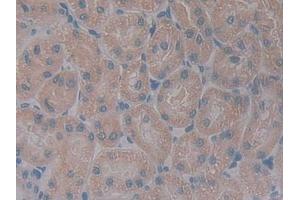 Detection of GHR in Rat Kidney Tissue using Polyclonal Antibody to Growth Hormone Receptor (GHR) (Growth Hormone Receptor anticorps  (AA 353-588))