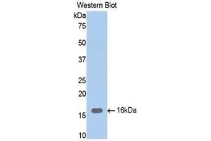 Detection of Recombinant ENG, Mouse using Polyclonal Antibody to Endoglin (ENG)