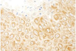 Immunohistochemistry (IHC) image for anti-Mitogen-Activated Protein Kinase Kinase Kinase MLT (ZAK) (AA 750-800) antibody (ABIN7454426)