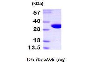 SDS-PAGE (SDS) image for Nitrilase Family, Member 2 (NIT2) (AA 1-276) protein (His tag) (ABIN667846)