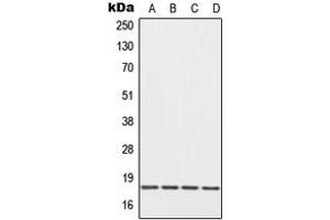 Western blot analysis of EIF5A expression in Raji (A), HepG2 (B), Raw264. (EIF5A anticorps  (Center))