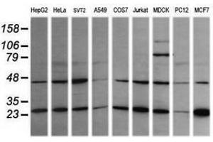 Image no. 4 for anti-RAB21, Member RAS Oncogene Family (RAB21) antibody (ABIN1500541)