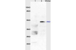 Lane 1: mouse brain lysates Lane 2: mouse lung lysates probed with Anti HDAC3 Polyclonal Antibody, Unconjugated (ABIN734903) at 1:200 in 4 °C.
