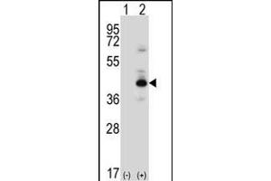 Western blot analysis of PRKACB (arrow) using rabbit polyclonal PRKACB Antibody (K29) (ABIN6243845 and ABIN6578978). (PRKACB anticorps  (N-Term))