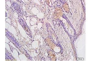 Formalin-fixed and paraffin embedded rat cells labeled with Rabbit Anti-CD4 Polyclonal Antibody, Unconjugated (ABIN672936) 1:300 followed by conjugation to the secondary antibody and DAB staining.