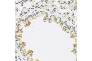 Immunohistochemistry of paraffin-embedded mouse lung using TGFB3 antibody (ABIN5974864) at dilution of 1/100 (40x lens). (TGFB3 anticorps)