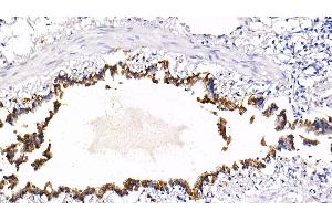 Detection of CK18 in Rat Lung Tissue using Polyclonal Antibody to Cytokeratin 18 (CK18)