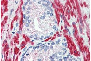 Anti-TRPM8 antibody  ABIN960829 IHC staining of human prostate. (TRPM8 anticorps  (N-Term))
