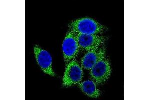 Immunofluorescence (IF) image for anti-Tuberous Sclerosis 2 (TSC2) (pSer1387) antibody (ABIN3001803) (Tuberin anticorps  (pSer1387))