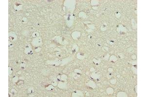 Immunohistochemistry of paraffin-embedded human brain tissue using ABIN7172953 at dilution of 1:100 (TMCC1 anticorps  (AA 51-300))
