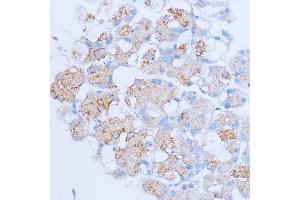 Immunohistochemistry of paraffin-embedded rat pancreas using NME6 antibody (ABIN7268942) at dilution of 1:100 (40x lens). (NME6 anticorps  (AA 9-194))