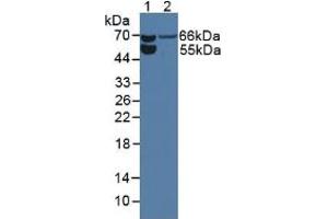 Western blot analysis of (1) Rat Serum and (2) Rat Kidney Tissue. (Endoglin anticorps  (AA 26-136))