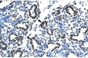 Human Lung; CLDN17 antibody - middle region in Human Lung cells using Immunohistochemistry (Claudin 17 anticorps  (Middle Region))