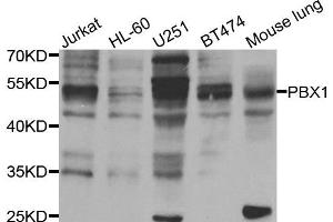 Western blot analysis of extracts of various cell lines, using PBX1 antibody. (Prolactin anticorps)