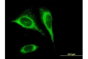 Immunofluorescence of purified MaxPab antibody to SLC25A24 on HeLa cell. (SLC25A24 anticorps  (AA 1-477))
