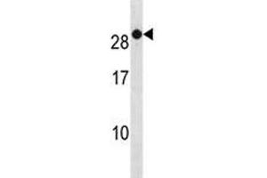 RAB7B antibody western blot analysis in A2058 lysate.