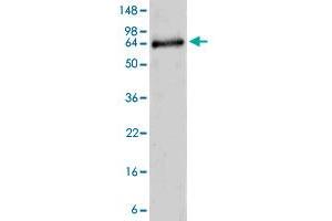Image no. 1 for ADAM Metallopeptidase with Thrombospondin Type 1 Motif, 10 (ADAMTS10) (AA 214-672) protein (ABIN5569876)