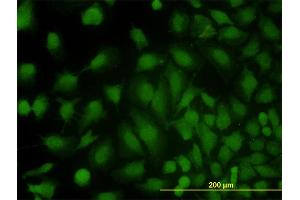 Immunofluorescence of monoclonal antibody to MVP on HeLa cell.