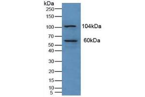Western blot analysis of Human Liver Tissue. (PKN1 anticorps  (AA 615-874))
