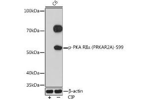 Western blot analysis of extracts of C6 cells, using Phospho-PKA RIIα (PRKA)-S99 Rabbit mAb (ABIN7269661) at 1:1000 dilution. (PRKAR2A anticorps  (pSer99))