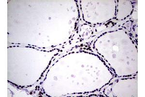 Image no. 10 for anti-Nibrin (NBN) (AA 183-460) antibody (ABIN1491066)