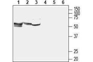 Western blot analysis of rat placenta lysate (lanes 1 and 4), mouse testes lysate (lanes 2 and 5) and rat skeletal muscle membrane (lanes 3 and 6): - 1-3.