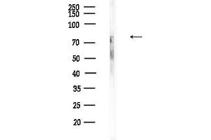 anti-Protein Kinase C, theta (PRKCQ) (pSer676) antibody