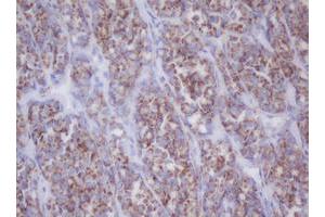 Image no. 1 for anti-Mitochondrial Translational Initiation Factor 3 (MTIF3) (AA 56-278) antibody (ABIN1491590)